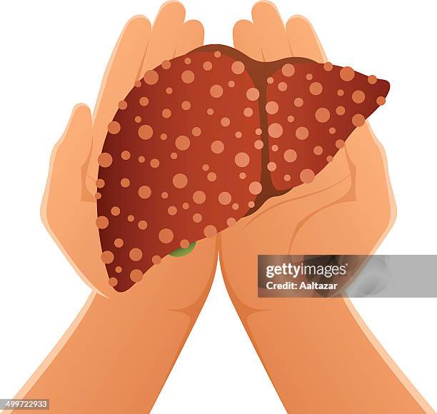 hands holding cirrhotic liver - human circulatory system stock illustrations