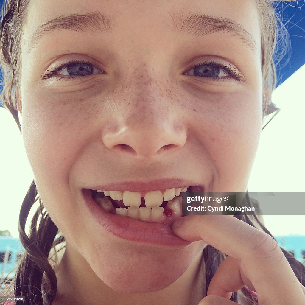 Girl with Lost Tooth