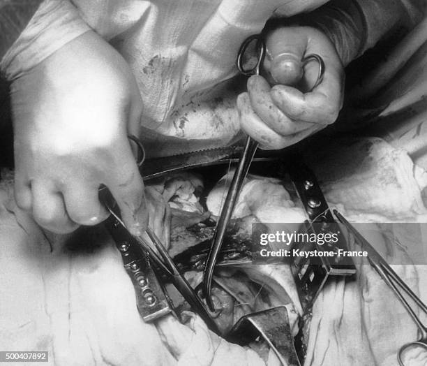 Performing open-heart surgery at Ostrava's hospital, 1960 in Ostrava, Czech Republic.