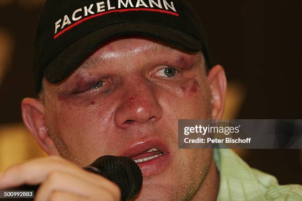 Axel Schulz, A x e l S c h u l z Box-Comeback, Pressekonferenz nach verlorenem Kampf, Halle-Westfalen, Deutschland, , P.-Nr.: 1802/2006, Verletzung,...