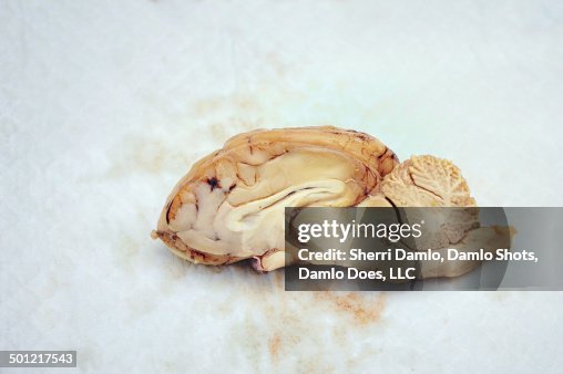 Sheep brain dissection Sheep brain dissection