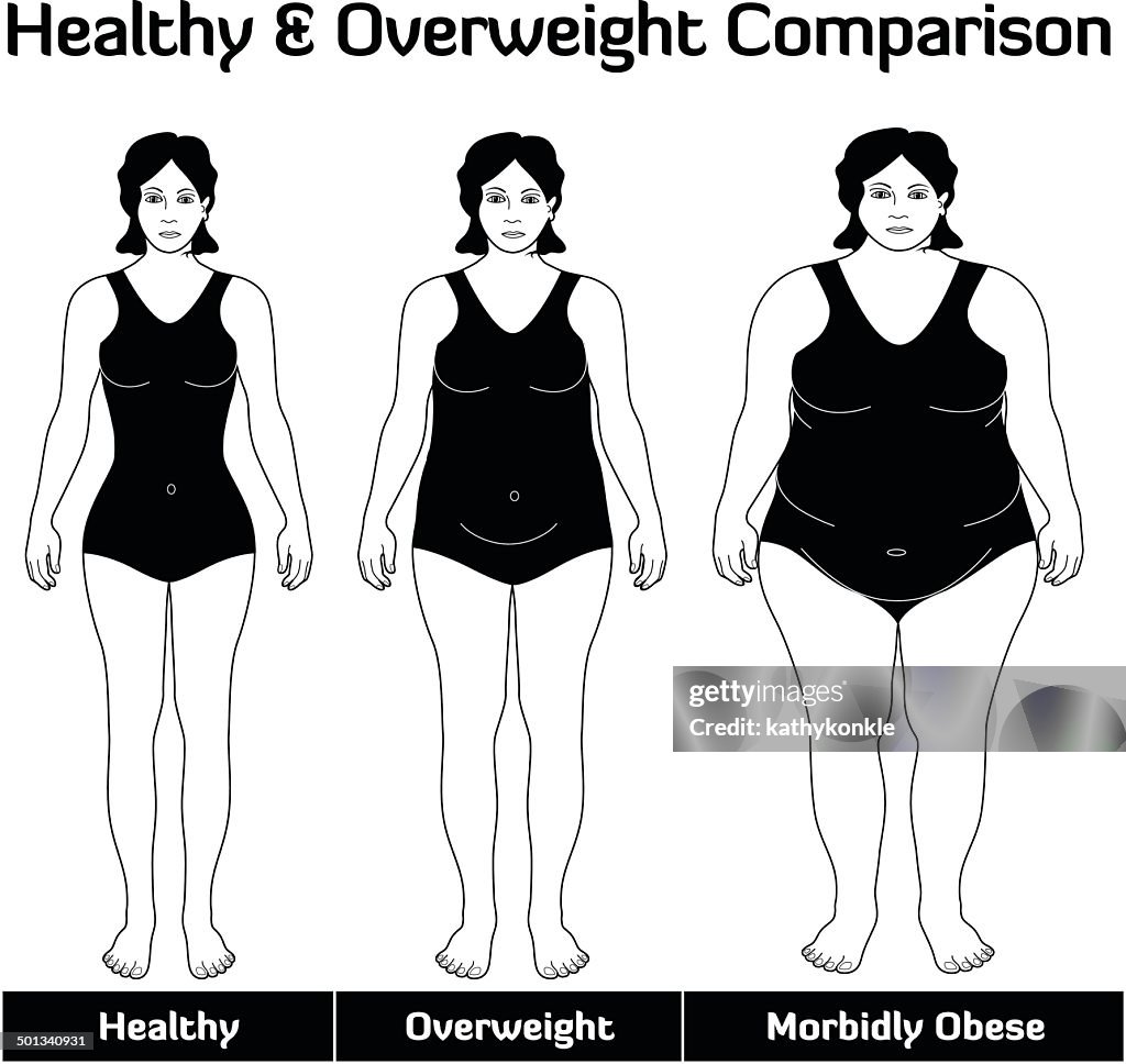 Overweight Example Healthy And Overweight Comparison High-Res Vector Graphic - Getty Images