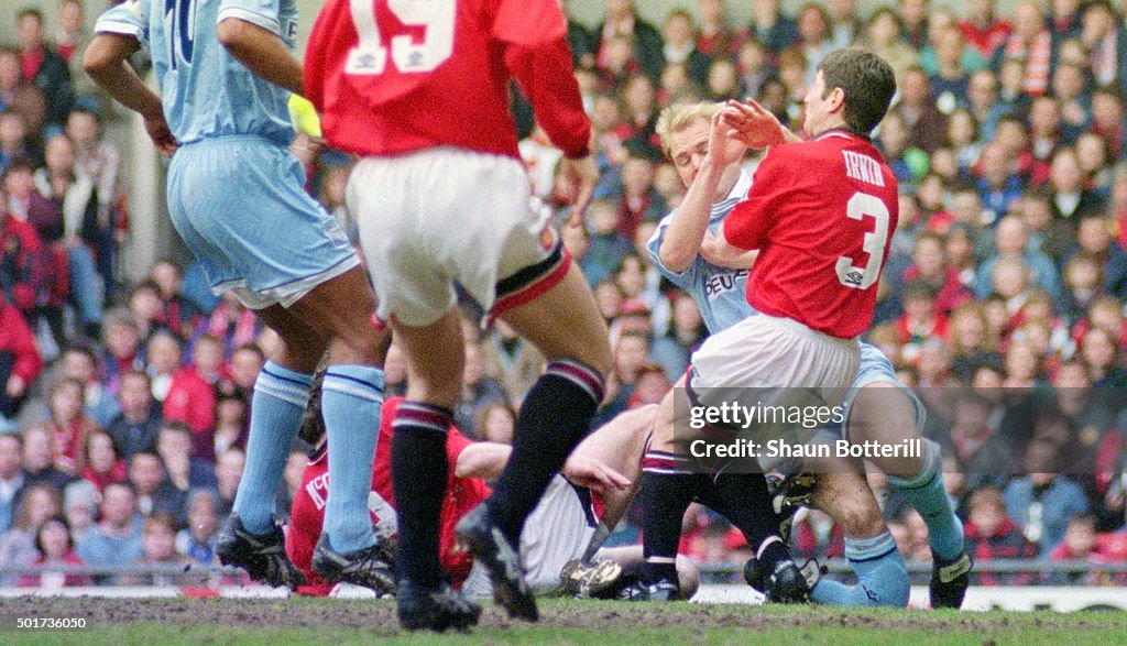 Coventry City Defender David Busst Breaks His Leg Resulting In News coventry-city-defender-david-busst-breaks-his-leg-resulting-in-news