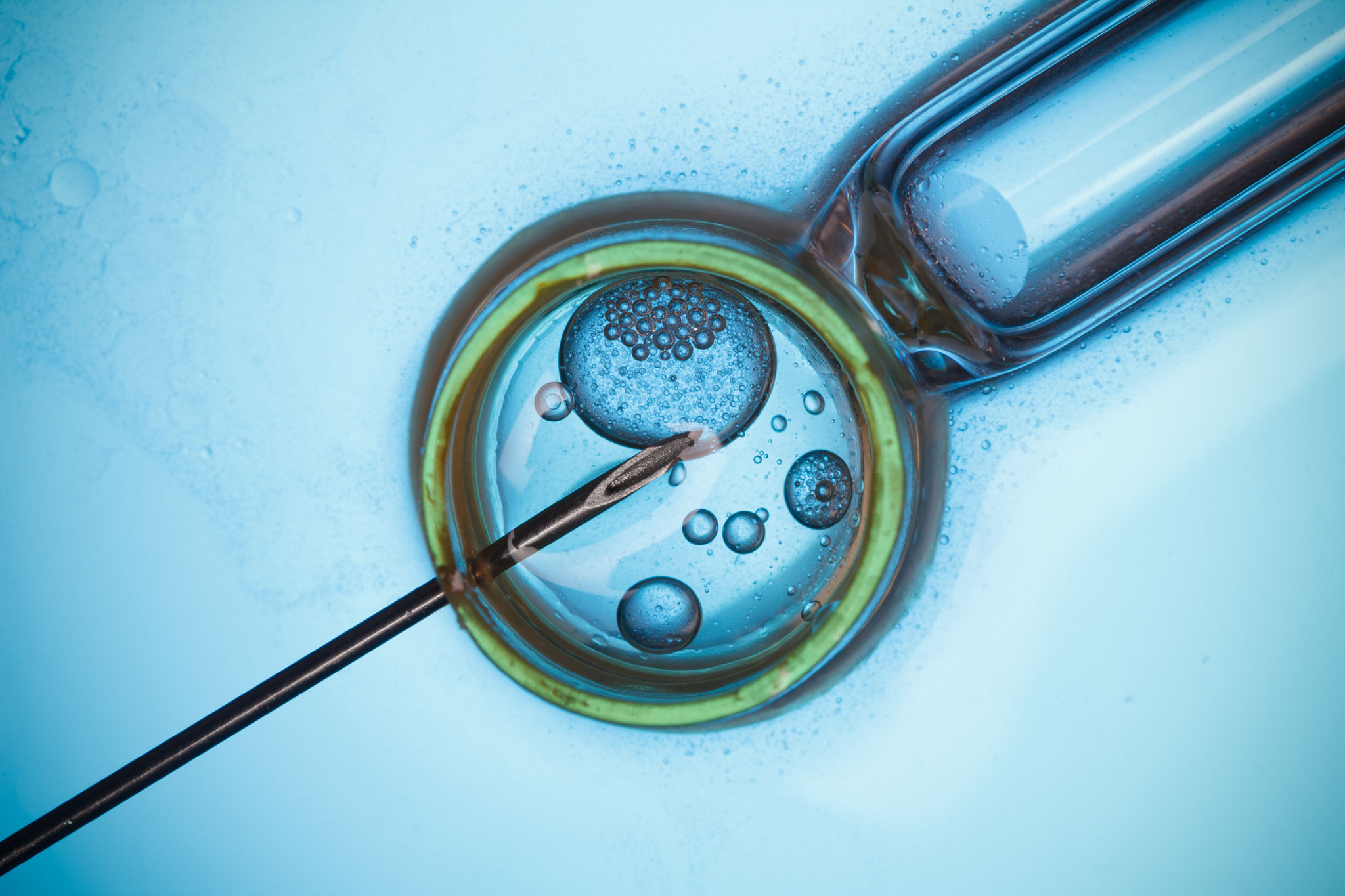fertility technology