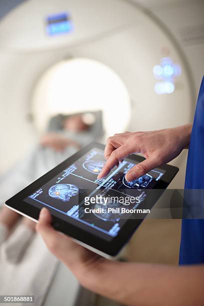 radiographer looking at brain scan image on digital tablet - ct röntgen bildbanksfoton och bilder