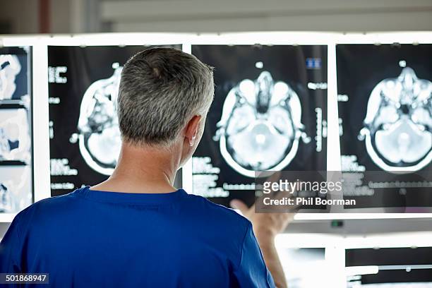 radiologist looking at brain scans - brain scan stock-fotos und bilder