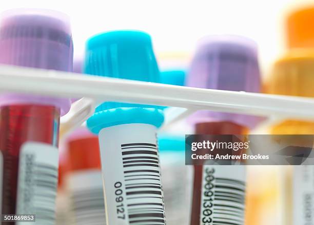 a row of human blood and chemistry samples awaiting testing in the lab - provetta per campioni ematici foto e immagini stock