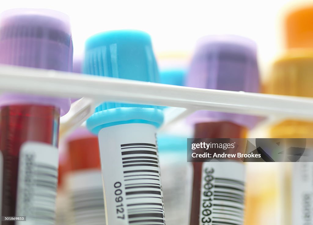 Lab Human Sample A Row Of Human Blood And Chemistry Samples Awaiting Testing In The Lab ...