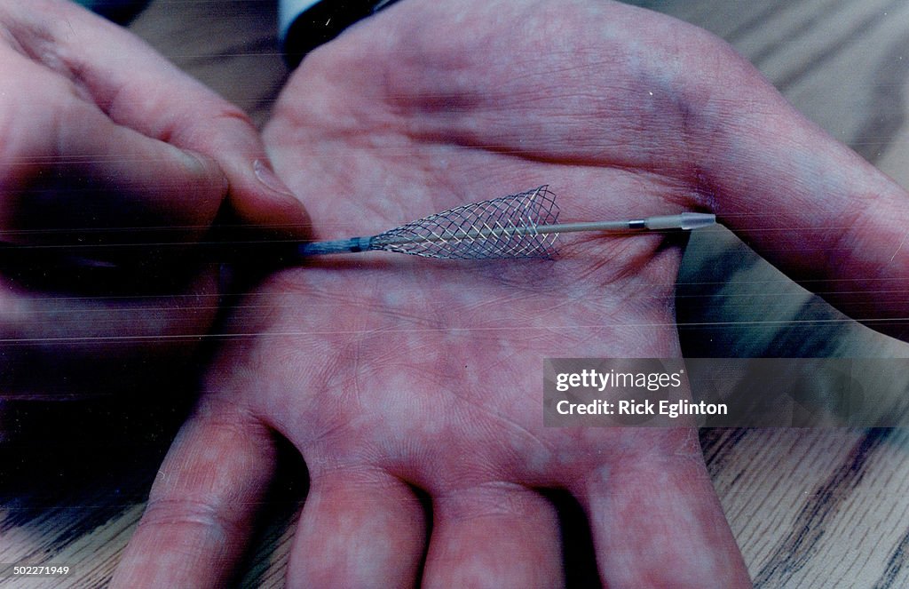 Medical Marvel: The average carotid stent is about 10 millimeters in diameter and 8 to 10 millimetre