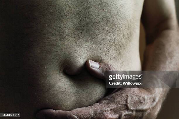dunklen mann umbilical hernia angefutterten pfunde zu kämpfen - deformed hand stock-fotos und bilder