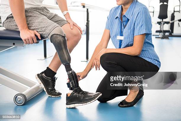 medical professional helping man with prosthetic leg - 四肢 個照片及圖片檔