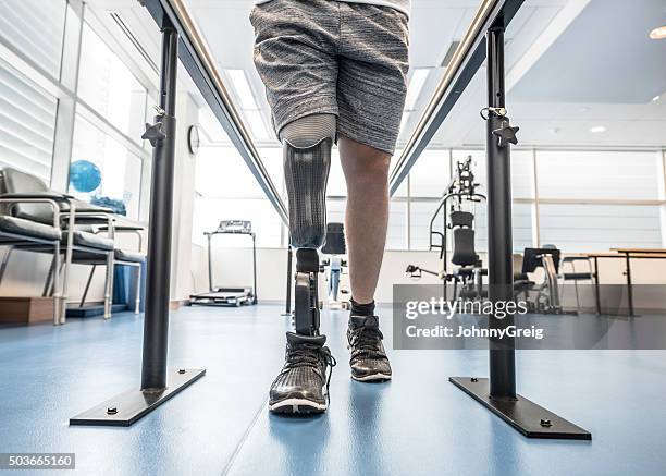 mann mit einer beinprothese mit parallel bars - prothese stock-fotos und bilder