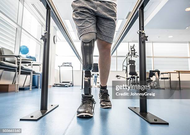 hombre con una pierna ortopédica con barras paralelas - rehabilitación fotografías e imágenes de stock