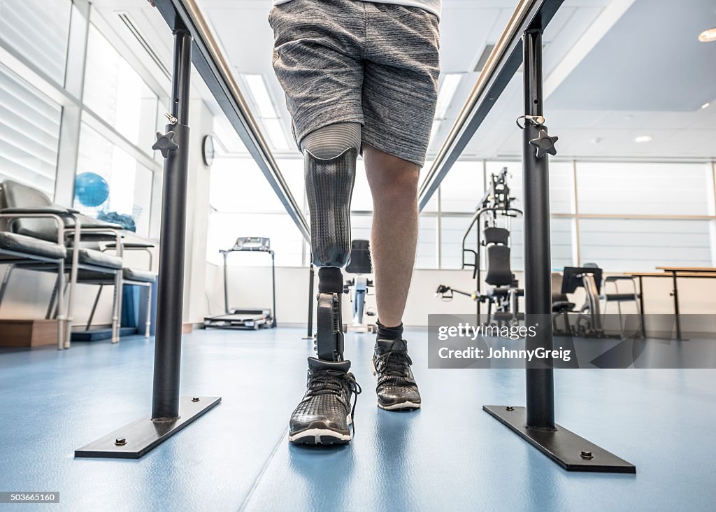 Man with prosthetic leg using parallel bars