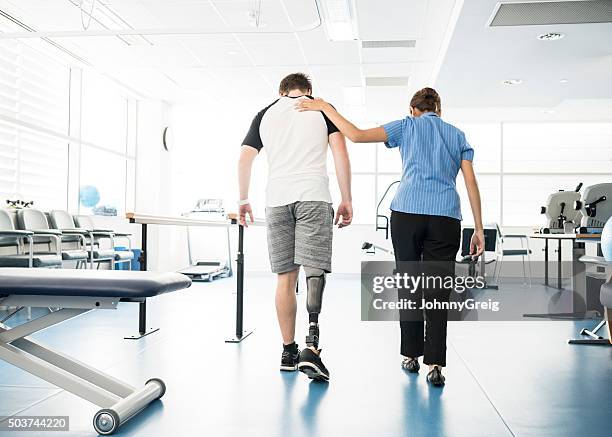 physiotherapist helping young man with prosthetic leg - amputatie stockfoto's en -beelden