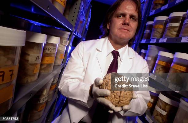 University of Kentucky researcher Dr. David Snowdon holding a brain from the collection of donor brains which he has been studying since 1996 as part...