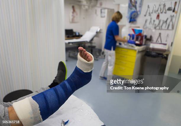 plaster cast on a fractured leg - doctor patient cast stock-fotos und bilder