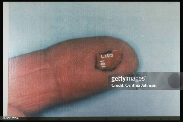 Fingertip-held Toshiba radio fragment recovered from the bombing of Pan Am flight 103 over Lockerbie Justice Department evidence in indictment of 2...