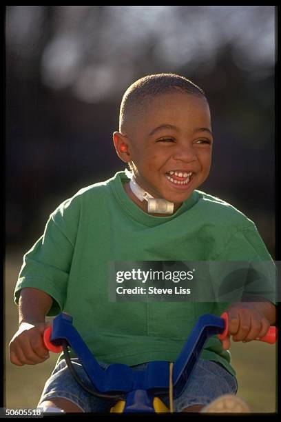 Allen riding tricycle yr. After surviving Alfred P Murrah Federal bldg. Bombing w. Injuries leaving him w. Grave respiratory problems.