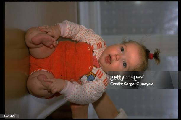 Toddler w. Limb deformities, birth defect due to radiation contamination fr. 1986 nuclear plant accident, at children's home for Chernobyl victims.