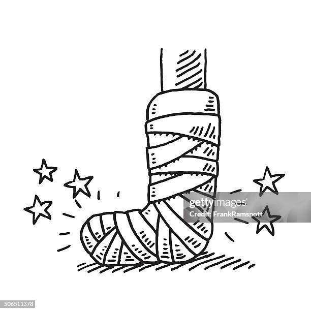ilustraciones, imágenes clip art, dibujos animados e iconos de stock de pierna fracturada lesión vendaje dibujo - escayola