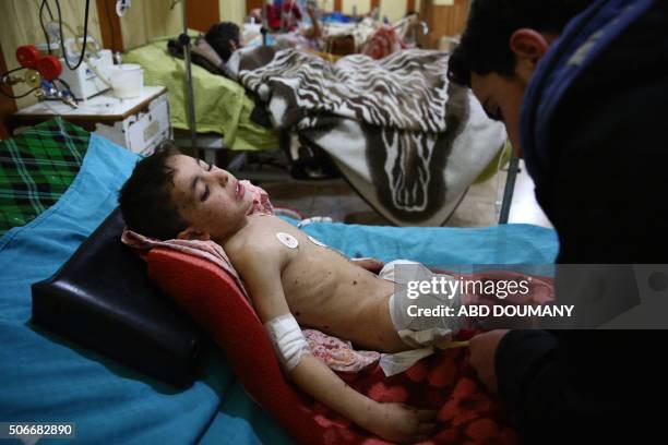 Graphic content / Nureldine al-Tout, a five year old Syrian boy who recently lost his legs in a barrel bomb attack, prepares to leave the hospital to...