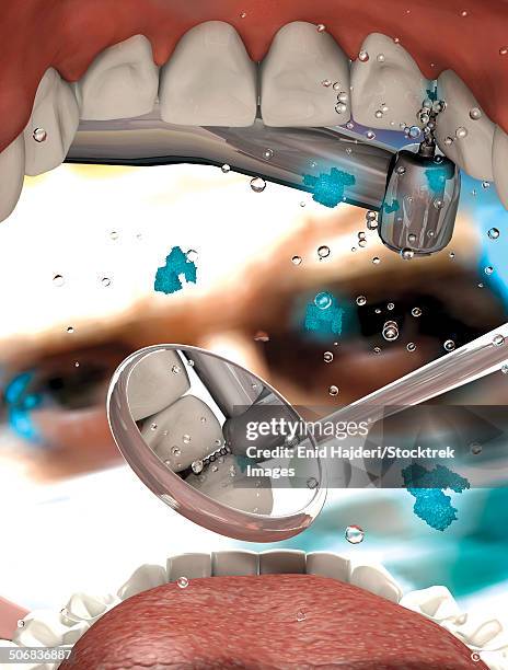 view looking from inside the mouth while at the dentist. - checking teeth mirror stock illustrations
