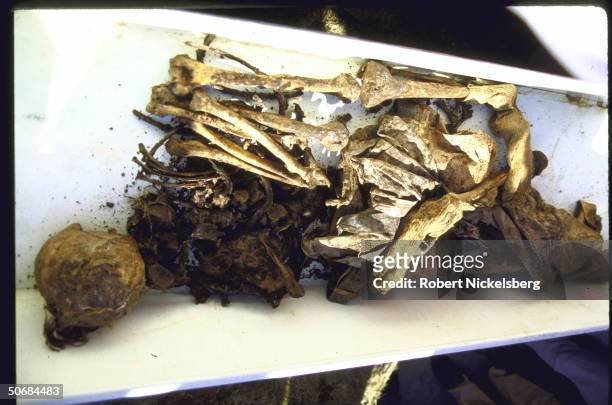 Exhumed pile of bones and remains purportedly belonging to Nazi war criminal Josef Menqele.