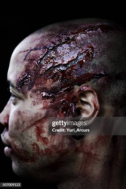 algo más espectaculares de esta manera se - head injury fotografías e imágenes de stock