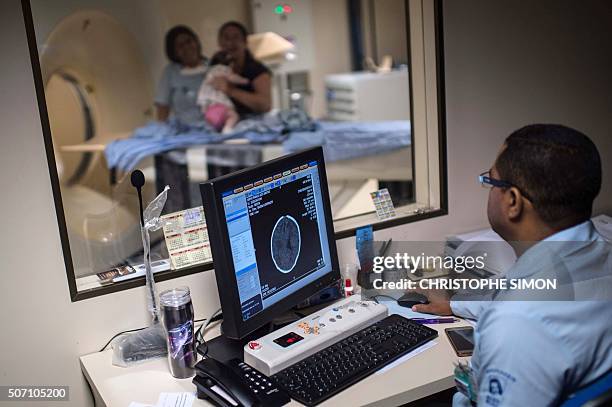 Doctors scan the brain of a newborn to detect a possible microcephalia caught through an Aedes aegypti mosquito bite, at the Obras Sociais Irma Dulce...