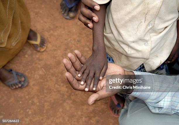 thin starving child's hand in adult's hand. - somalia foto e immagini stock