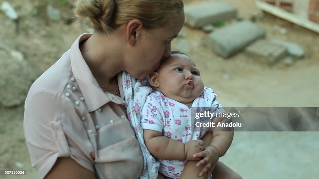 Zika Virus in Brazil