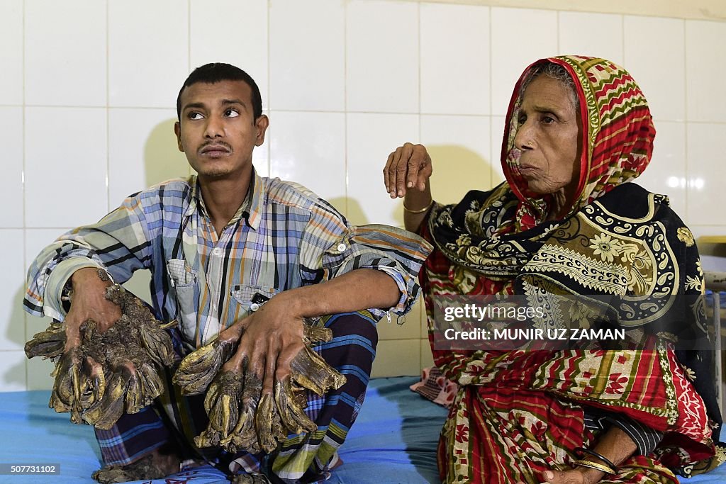 BANGLADESH-HEALTH-PEOPLE