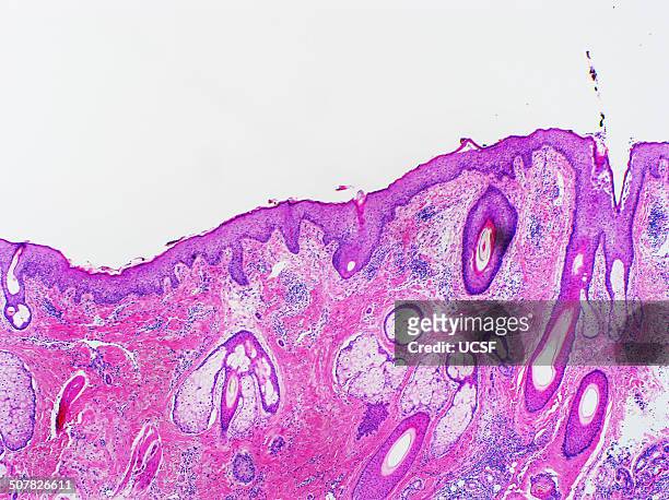 h&e stain, light microscopy, normal skin of scalp - hematoxylin and eosin staining stockfoto's en -beelden