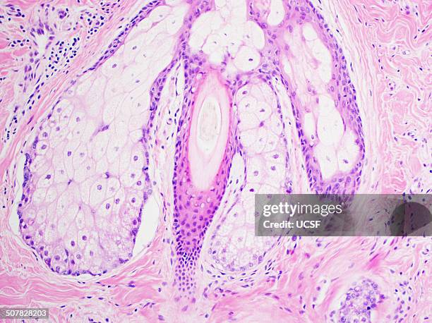 h&e stain, light microscopy, normal hair follicle - ヘマトキシリンエオジン染色 ストックフォトと画像