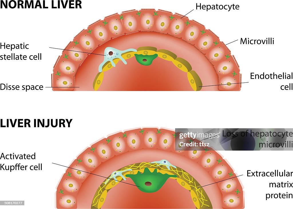 Normal Liver Element Normal Liver And Liver Injury High-Res Vector Graphic - Getty Images