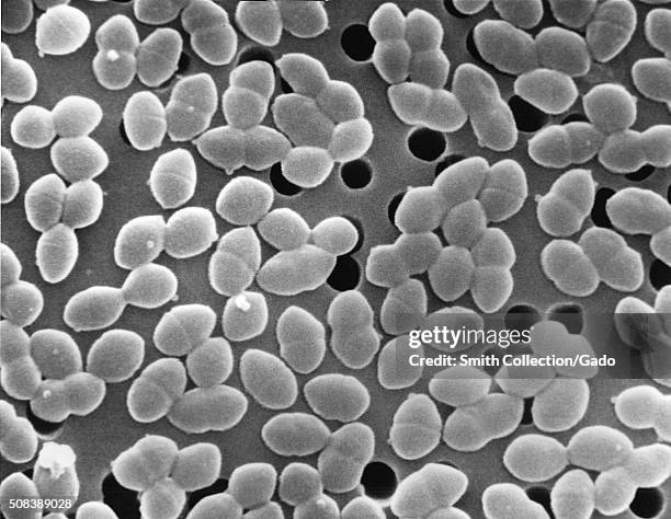 This scanning electron micrograph depicts bacteria, which were identified as being Gram-positive Enterococcus sp. Bacteria. Previously identified as...