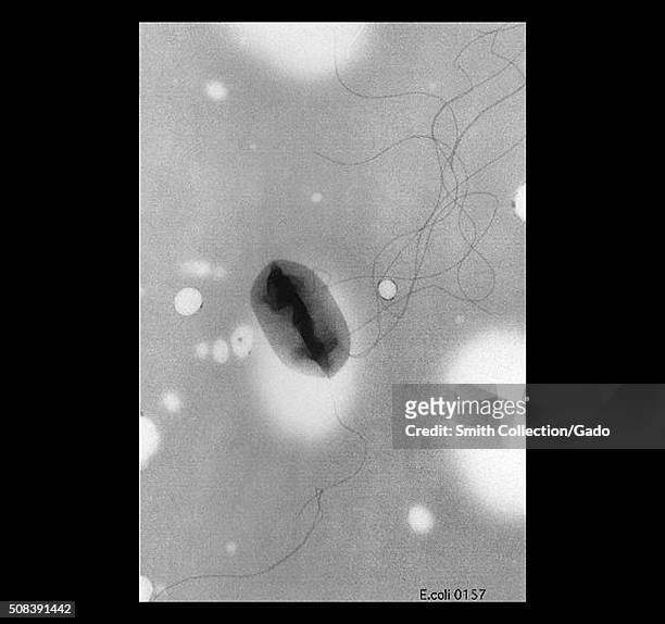 This transmission electron micrograph revealed some of the ultrastructural morphology of a flagellated Escherichia coli O157:H7 bacterium....