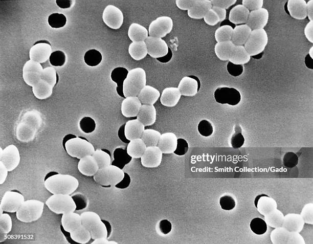 Scanning Electron Micrograph of Enterococcus species. Image courtesy CDC. 1984. .
