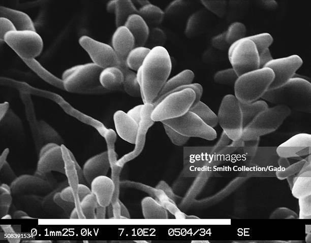 This scanning electron micrograph depicts a magnified view of a colony of the dematiaceous filamentous fungus Curvularia geniculata, revealing the...