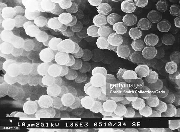 This scanning electron micrograph depicts numbers of chains of Aspergillus specie fungal conidiospores. Aspergillus is a fungus that is very common...