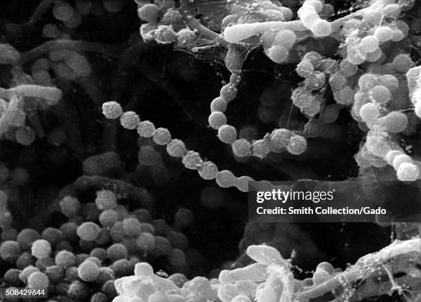 Scanning electron micrograph of Paecilomyces variotii fungal organisms. Image courtesy CDC. 1984. .
