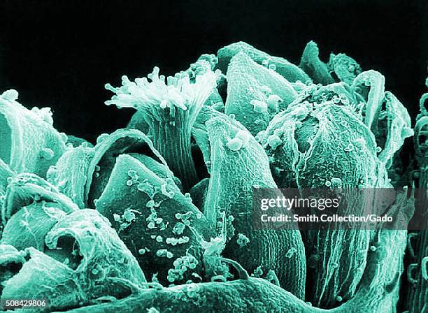 This is a scanning electron micrograph of an Ambrosia trifida plant, or more commonly known as ragweed. When ragweed pollen is disbursed, many people...