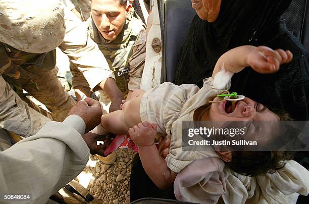 An Iraqi baby cries as U.S. Marines from the 1st platoon, Golf Company, 2nd Battalion, 7th Marines, 1st Marinies Division treat 3rd degree burns,...