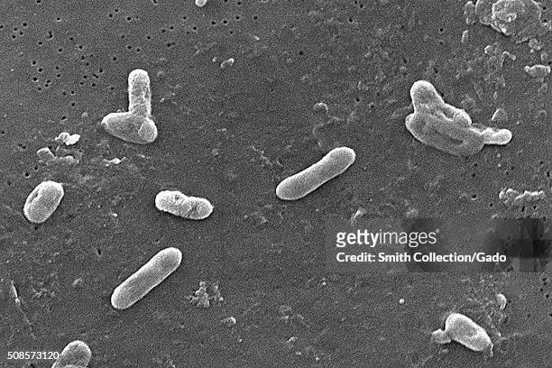 This scanning electron micrograph depicted a number of Gram-negative Bordetella bronchiseptica coccobacilli bacteria. This organism is commonly found...