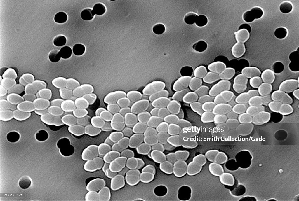 Vancomycin Resistant Gram-positive Enterococci