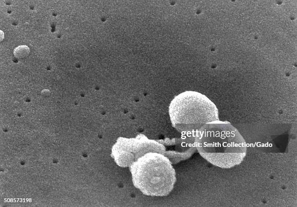 Scanning electron micrograph of a number of Gram-positive Streptococcus pneumoniae bacteria. Scanning Electron Micrograph of Streptococcus pneumoniae...