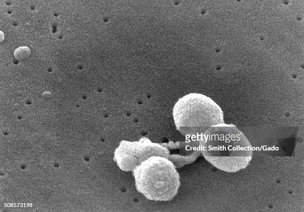 Scanning electron micrograph of a number of Gram-positive Streptococcus pneumoniae bacteria. Scanning Electron Micrograph of Streptococcus pneumoniae...