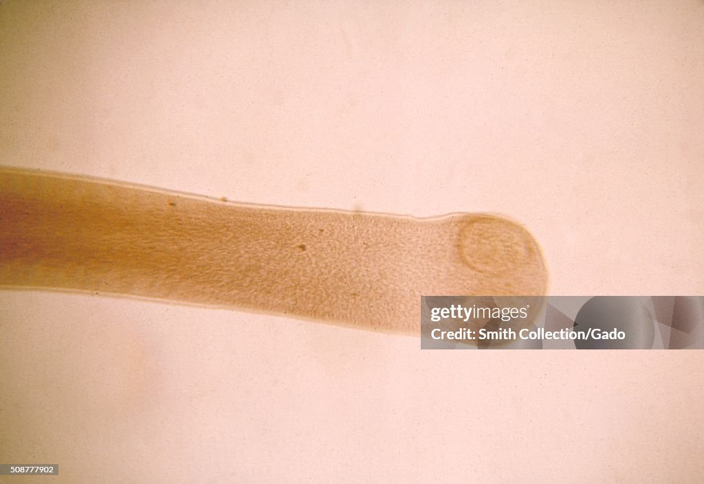 Hymenolepis Diminuta Scolex