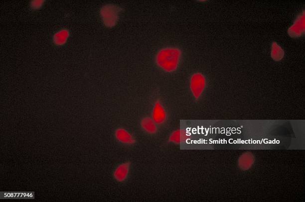 This photomicrograph depicts a negative indirect fluorescent antibody test for Giardia lamblia parasites. Image courtesy CDC/Dr. Govinda S....